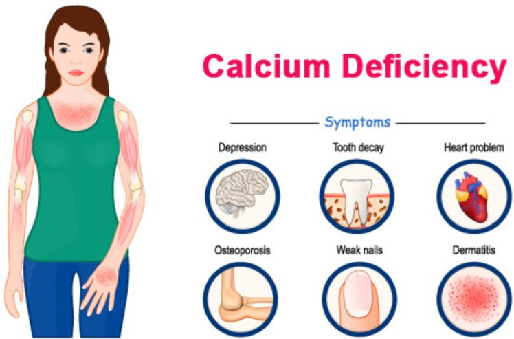 Impact of Calcium Deficiency